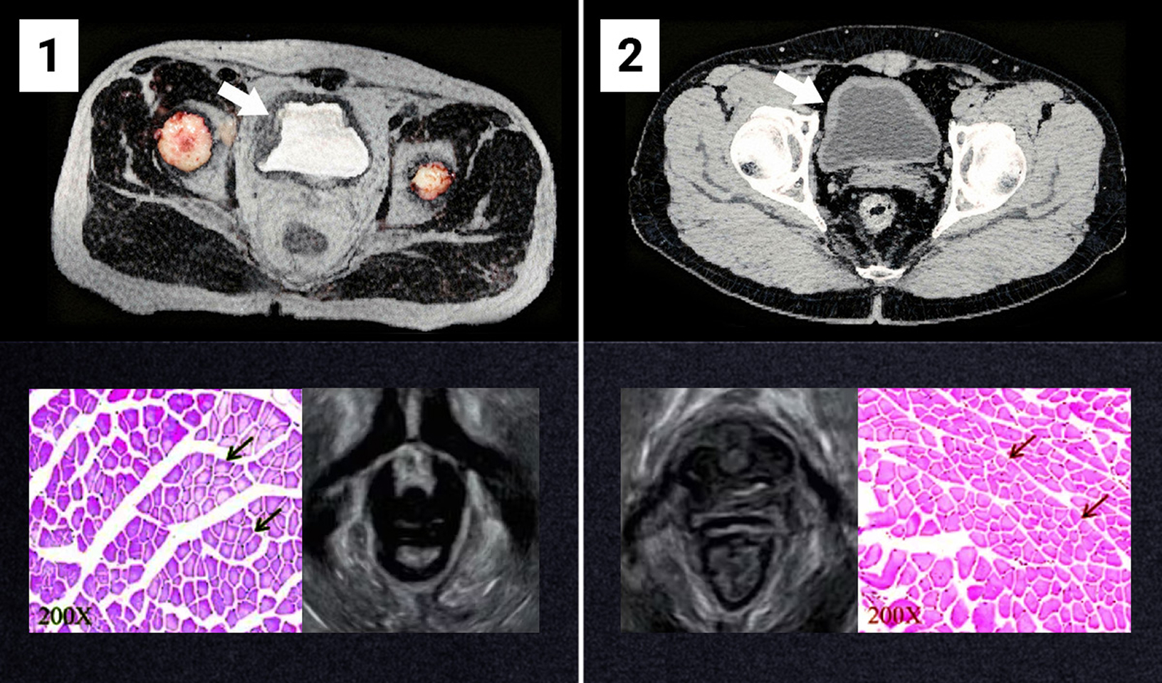 Obrazy medyczne pęcherza moczowego
